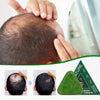 Juniper leaf shampoo and soap strengthens hair roots, prevents hair loss,
